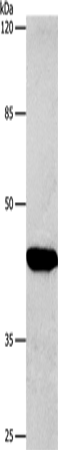 CTGF Polyclonal Antibody (E-AB-12339)