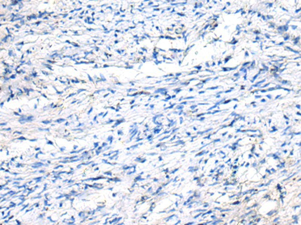 FGF11 Polyclonal Antibody (E-AB-19867)