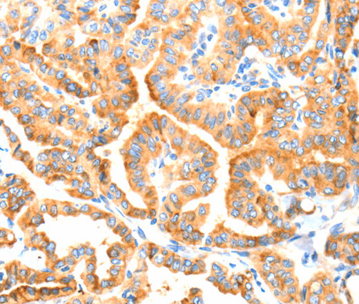MANF Polyclonal Antibody (E-AB-12987)