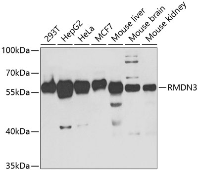 PTPIP51/RMDN3 Polyclonal Antibody (E-AB-92682)