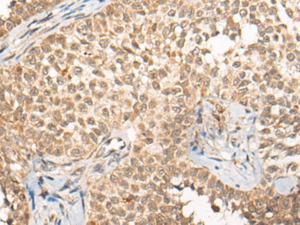CABIN1 Polyclonal Antibody (E-AB-17760)