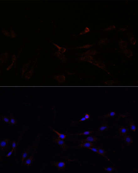 SUCLG1 Polyclonal Antibody (E-AB-65273)
