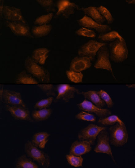 ROBO1 Polyclonal Antibody (E-AB-65262)