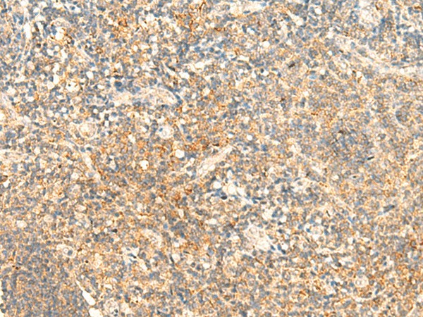 CD93 Polyclonal Antibody (E-AB-53290)