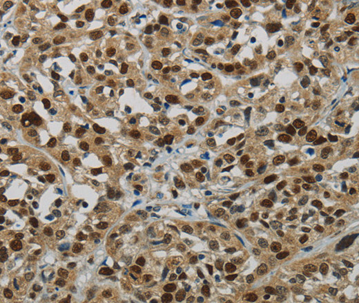DNA Ligase1 Polyclonal Antibody (E-AB-14958)
