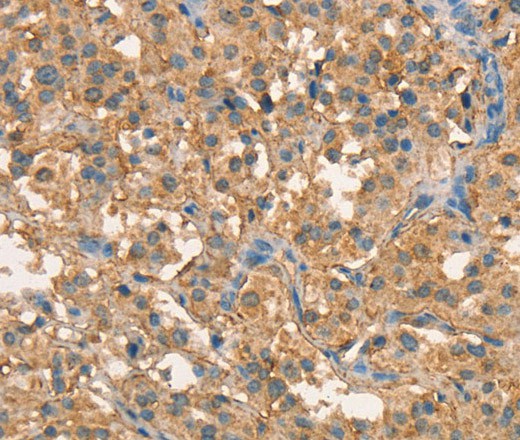 CRELD1 Polyclonal Antibody (E-AB-16357)