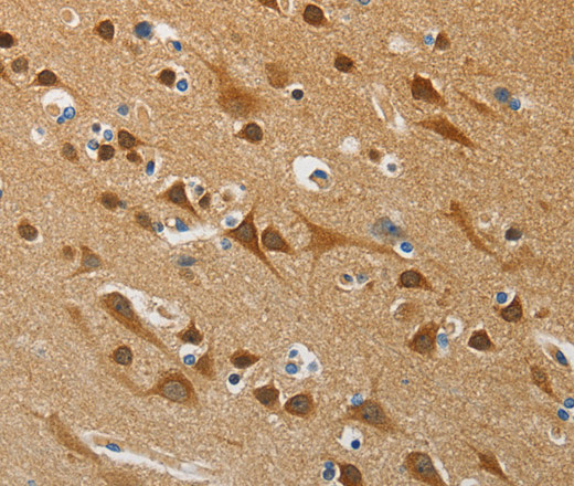 ATG4B Polyclonal Antibody (E-AB-12998)
