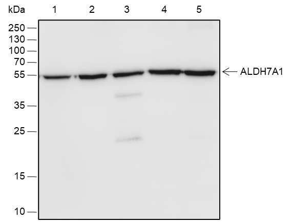 Recombinant ALDH7A1 Monoclonal Antibody (AN301848L)