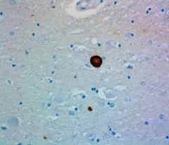 Purified anti-α-Synuclein, 103-108 Antibody (Previously Covance catalog# SIG-39730) (807804)