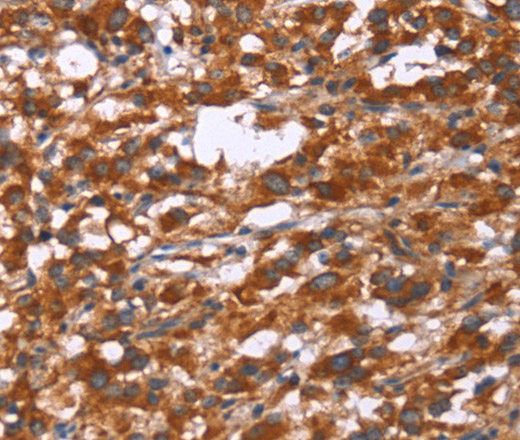 Gphn Polyclonal Antibody (E-AB-13263)