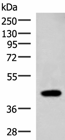 ADH1B Polyclonal Antibody (E-AB-19317)