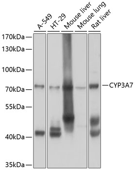 CYP3A7 Polyclonal Antibody (E-AB-62705)