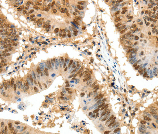 SSB Polyclonal Antibody (E-AB-16073)