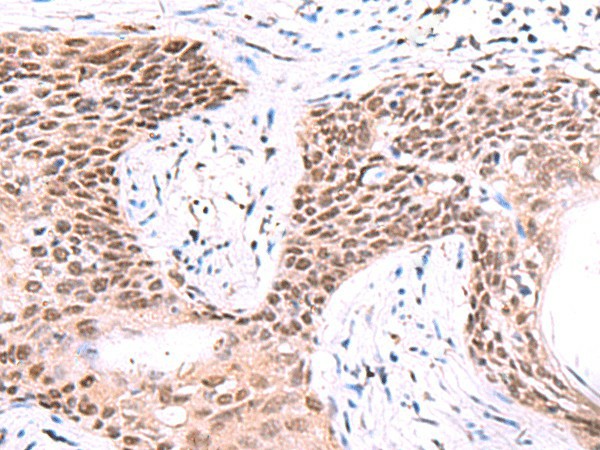 IRF2BP1 Polyclonal Antibody (E-AB-18126)