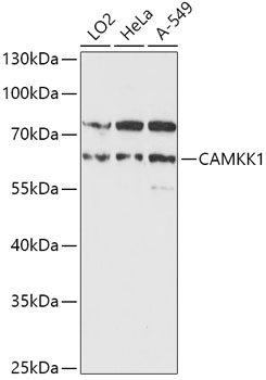 CAMKK1 Polyclonal Antibody (E-AB-91619)