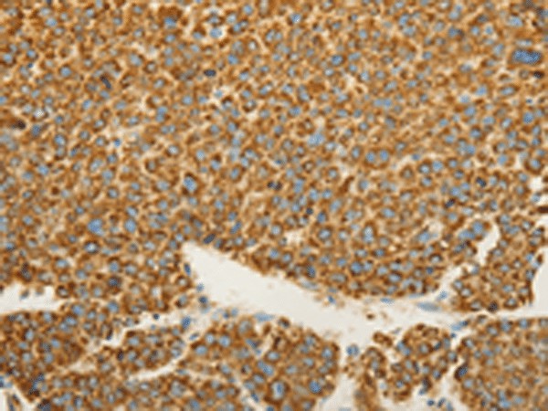 VDAC2 Polyclonal Antibody (E-AB-53192)