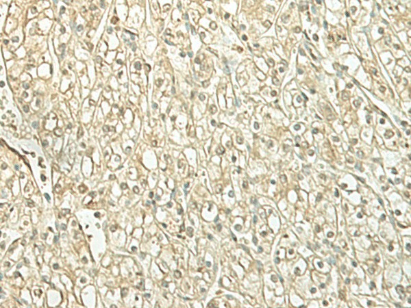 SPIRE1 Polyclonal Antibody (E-AB-52685)