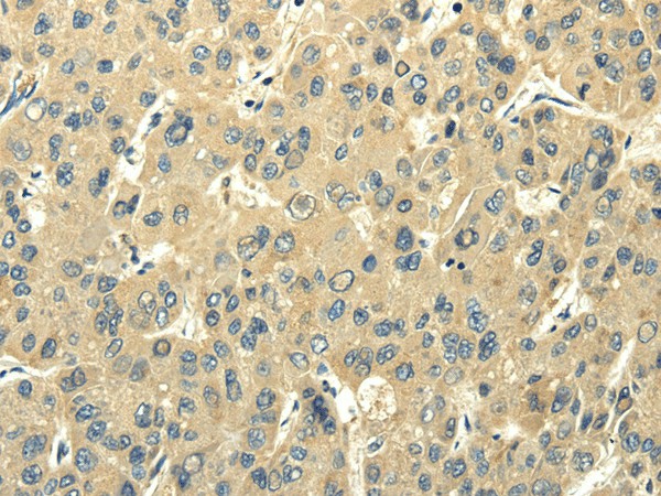 PMP2 Polyclonal Antibody (E-AB-16991)