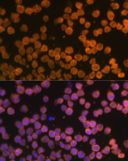 TNFRSF10A Polyclonal Antibody (E-AB-65927)