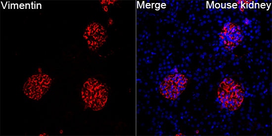(KO Validated) Vimentin Polyclonal Antibody (E-AB-63601)