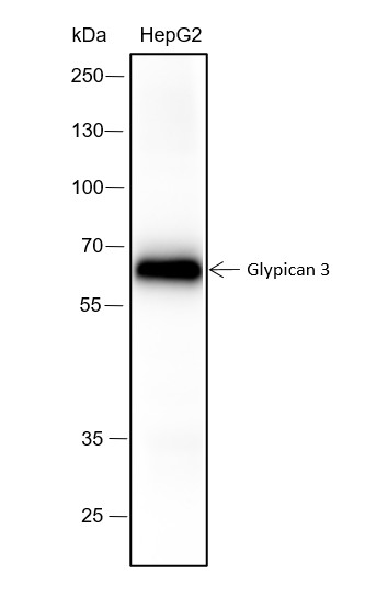 Recombinant Glypican 3 Monoclonal Antibody (AN301534L)