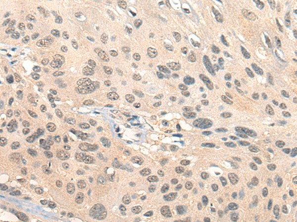 HIPK2 Polyclonal Antibody (E-AB-17849)