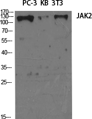 JAK2 Polyclonal Antibody (E-AB-31844)