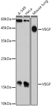 VEGF Polyclonal Antibody (E-AB-93319)