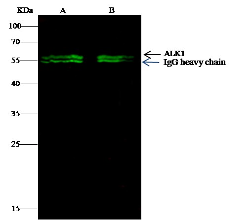 Recombinant ALK-1/ACVRL1 Monoclonal Antibody (AN300174P)