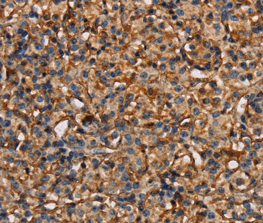 PLXNA1 Polyclonal Antibody (E-AB-16720)