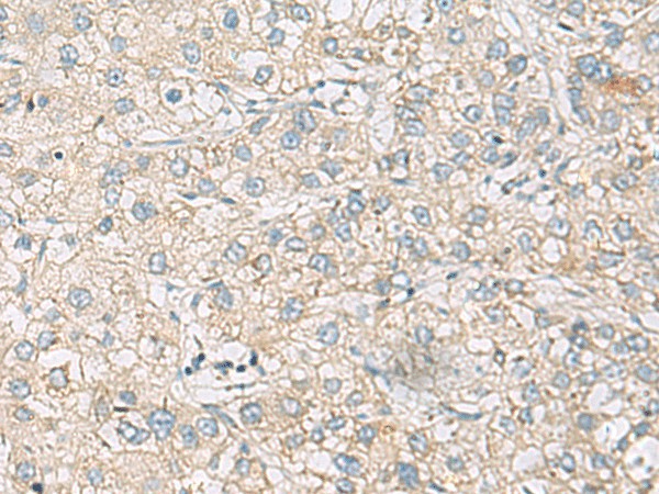 RAC2 Polyclonal Antibody (E-AB-53322)