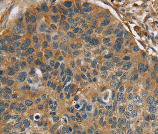 RIPK4 Polyclonal Antibody (E-AB-16762)