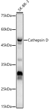 CTSD Polyclonal Antibody (E-AB-68296)
