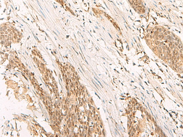 POP4 Polyclonal Antibody (E-AB-18945)