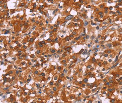HSPB6 Polyclonal Antibody (E-AB-13314)