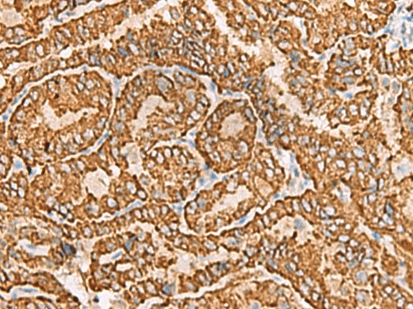 NPC2 Polyclonal Antibody (E-AB-18901)
