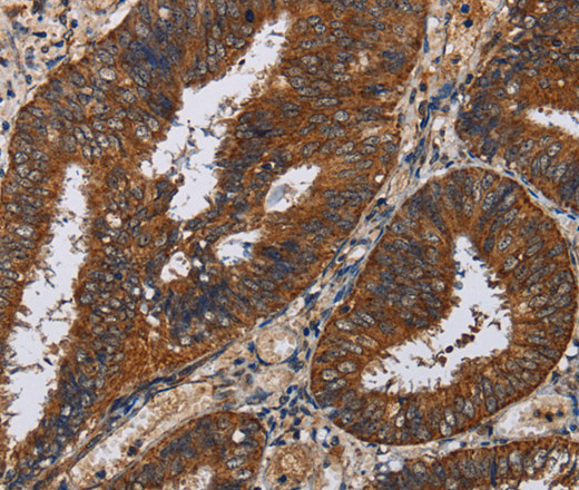 KLK11 Polyclonal Antibody (E-AB-15162)