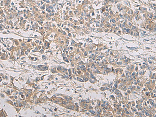 PA2G4 Polyclonal Antibody (E-AB-53185)
