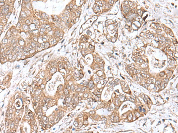 TEAD2 Polyclonal Antibody (E-AB-52638)
