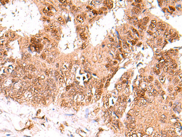 FDPS Polyclonal Antibody (E-AB-52941)