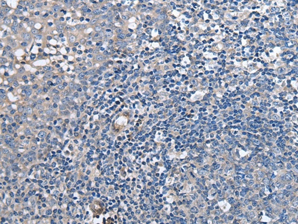 F3 Polyclonal Antibody (E-AB-19355)