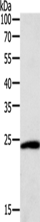 SNAP25 Polyclonal Antibody (E-AB-10601)