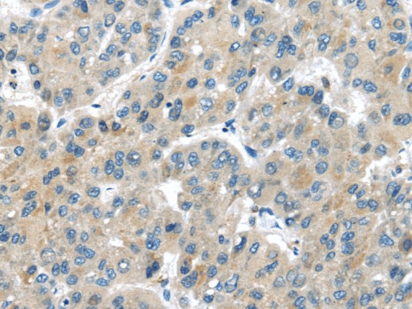 MASP2 Polyclonal Antibody (E-AB-17349)