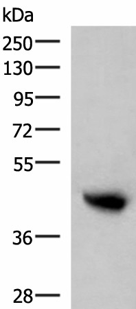 KIR2DL5A Polyclonal Antibody (E-AB-52098)