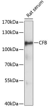 CFB Polyclonal Antibody (E-AB-66031)