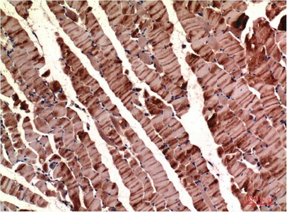 ACTA1 Monoclonal Antibody (E-AB-22225)