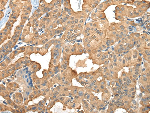 C1GALT1C1 Polyclonal Antibody (E-AB-18560)
