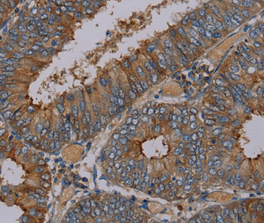 PYY Polyclonal Antibody (E-AB-13503)