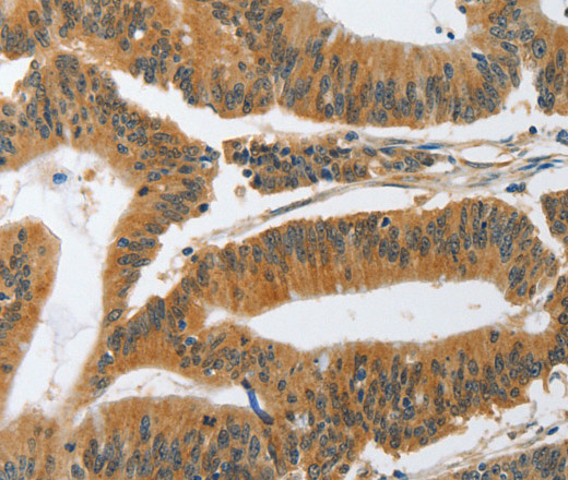 PIK3R3 Polyclonal Antibody (E-AB-13018)