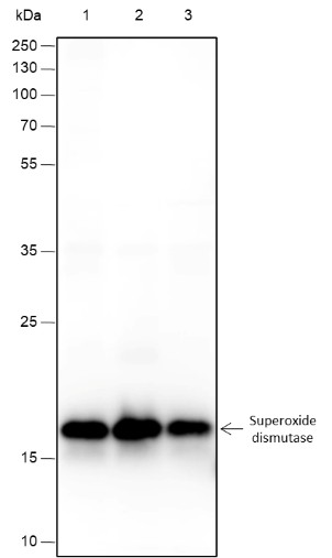 Recombinant SOD1 Monoclonal Antibody (AN301668L)